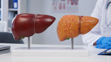 زیکورپا برای کبد چرب؛ شواهد علمی و نتایج درمانی